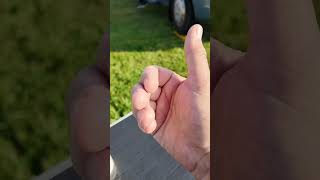 Using diet supplements to try and fix Trigger Finger. Week 4.