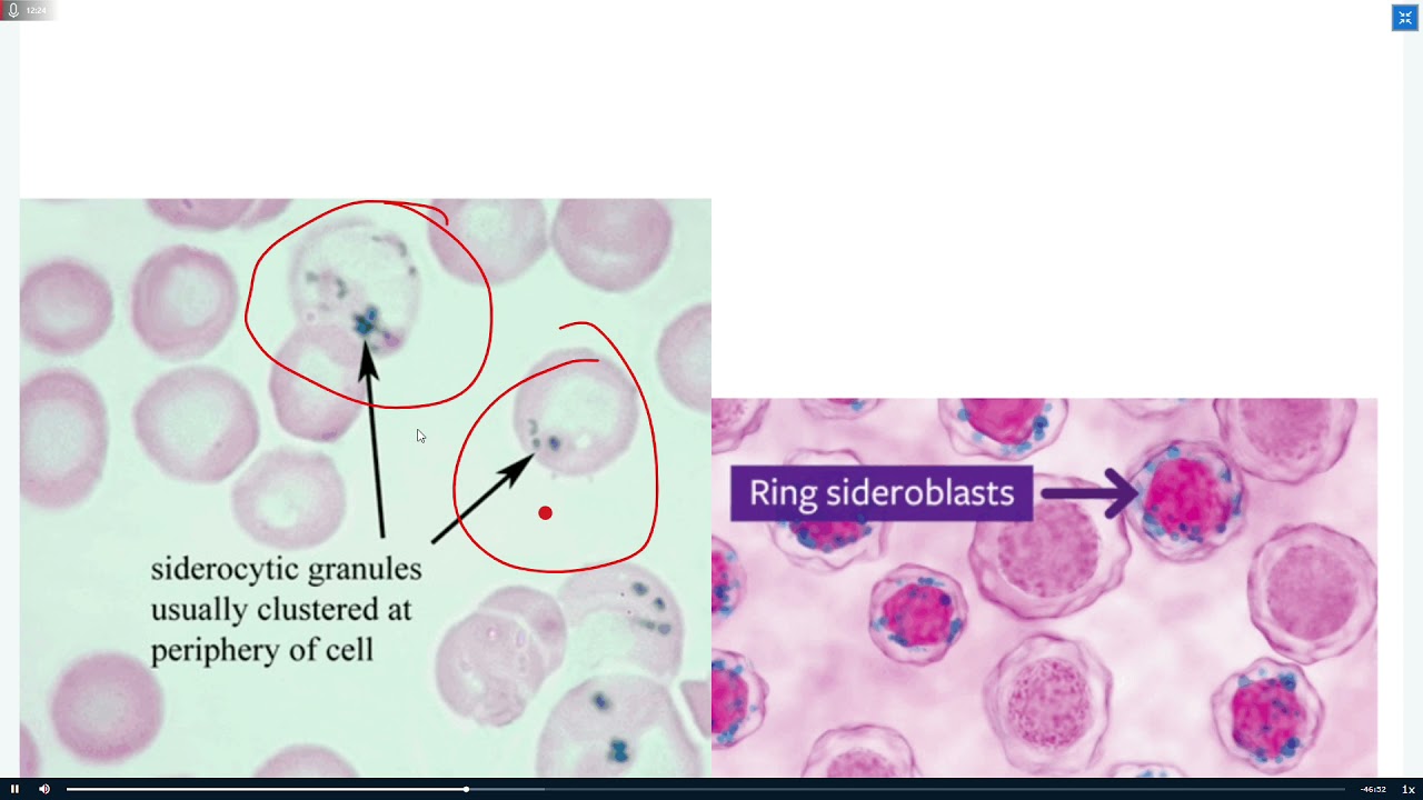 УРОК 8 ВКЛЮЧЕНИЯ В ЭРИТРОЦИТЫ