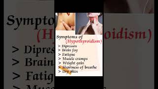 Hypothyroidism Symptoms health shorts youtube