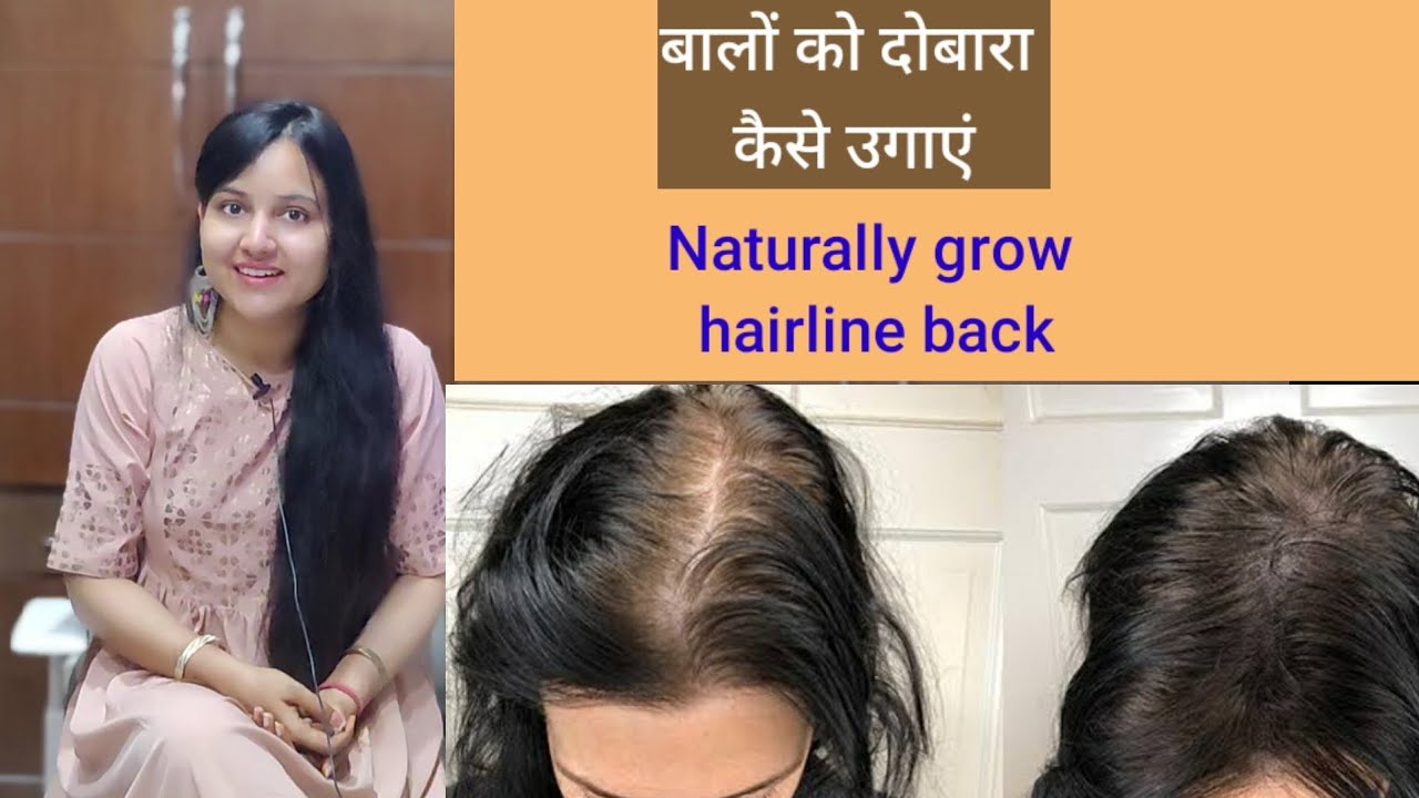 दबर बल उगन क 5 नचरल तरक य उपय दर करग गजपन  5 Natural  Ways to Grow Hair again in hindi