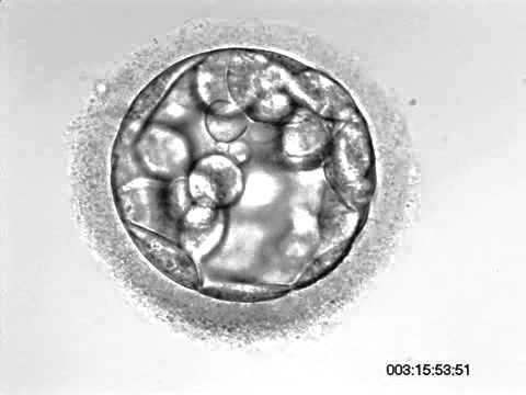 Wideo: Ile etapów komórkowych ma ludzka morula?
