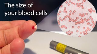 How Big Are My Blood Cells?