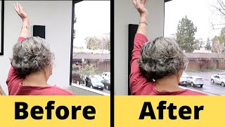 Frozen Shoulder: Before and After