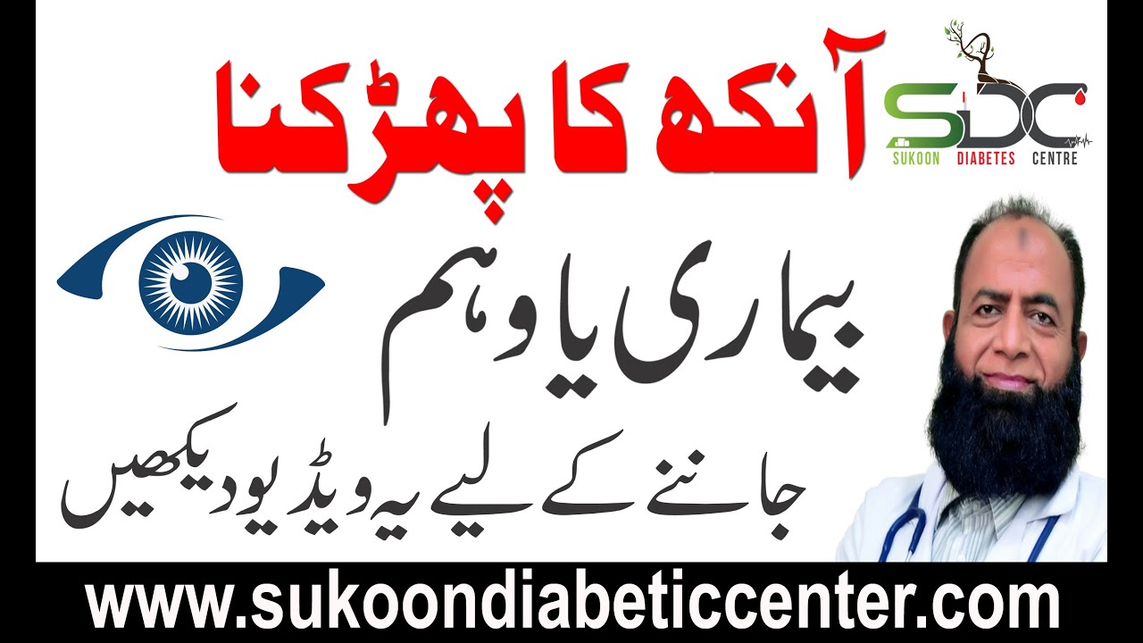 eye twitching treatment By Dr. Jawed Firdous Sukoon Diabetes