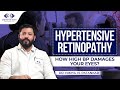 Understanding Hypertensive Retinopathy: Causes, Symptoms & Prevention with Dr. Nikhil N Patankar