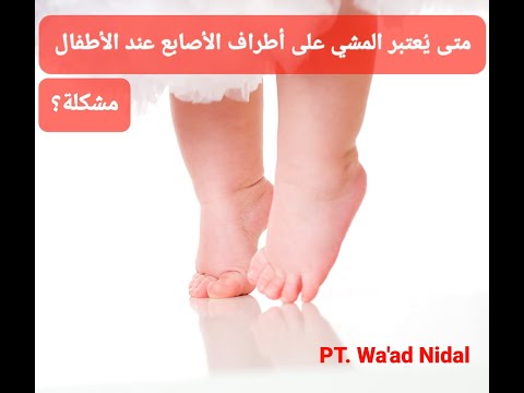 متى يعتبر المشي على أطراف الأصابع عند الأطفال مشكلة
