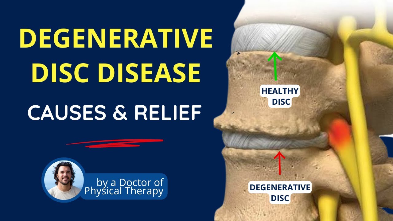 Degenerative Disc Disease, Back Pain Causes, Symptoms & Relief