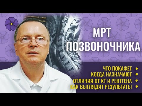 МРТ позвоночника - когда назначает врач, показания к проведению. Отличие от КТ.