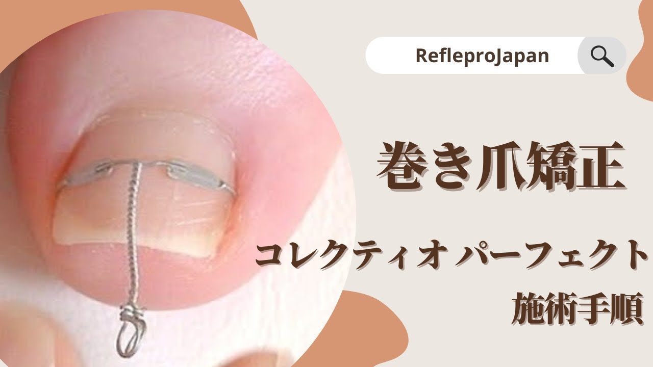 8-3673-12 巻き爪矯正ワイヤー コレクティオ ハード 1箱（20本入） R