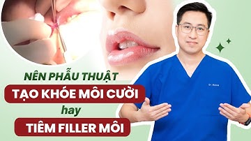 Nên phẫu thuật Tạo khóe môi cười hay Tiêm Filler?