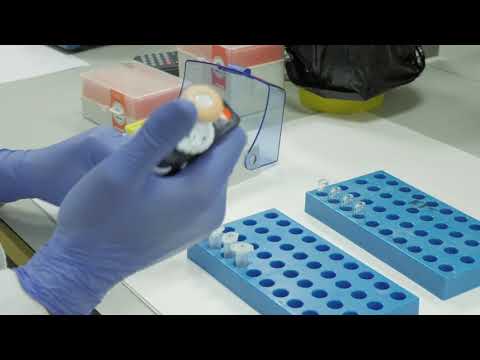 Video: Bloedonderzoek - Uitleg Van Een Gedetailleerde Bloedtest