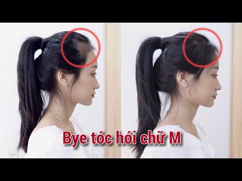 Video CÁCH CẮT TÓC CHE HÓI TRÁN CHỮ M HIỆU QUẢ NHẤT | TÓC BÒ... - youtube