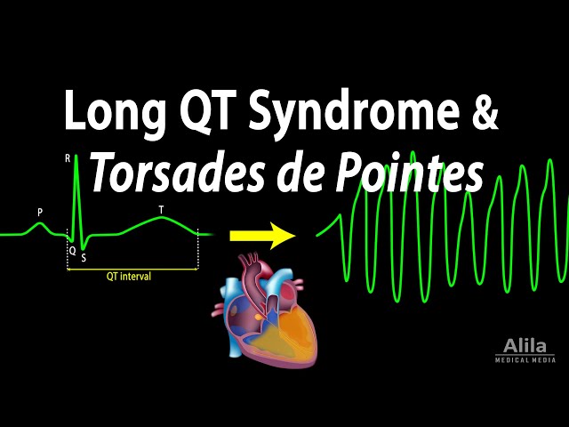 Long QT Syndrome and Torsades de Pointes, Animation class=