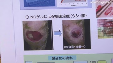 Nano-composite Hydrogels and Their Application to Healthcare : DigInfo [HD]