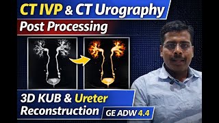 CT IVP & CT Urography Post Processing on GE ADW 4.4 | 3D KUB & Ureter Reconstruction #ivp #urography Profile