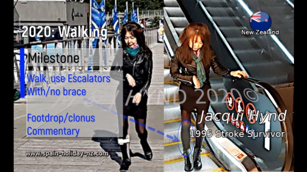 1995 AVM Stroke Survivor WALK/escalators with/No legbrace Jacqui Hynd