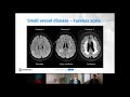 Dementia MRI interpretation - towards quantitative assessments