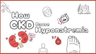 Reading On How Chronic Kidney Diseases Cause Hyponatremia? Ckd Its