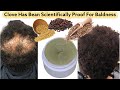 Clove for hair growth, Apply For One Month, Watch How Your Baldness/loss Will Start To Spring Out,