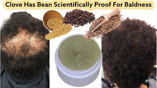 Clove for hair growth, Apply For One Month, Watch How Your Baldness/loss Will Start To Spring Out,