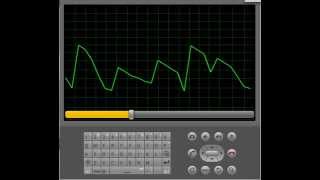 Android Electrocardiogram screenshot 4