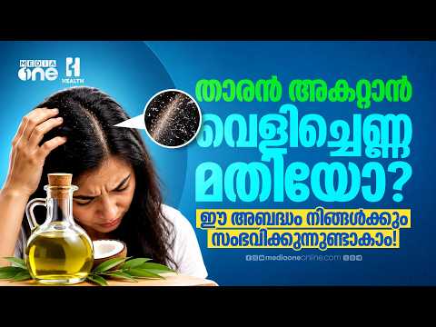 Is Coconut Oil Enough to Get Rid of Dandruff? You Might Be Making This Mistake Too! | MediaOne He...