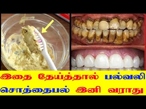 நீங்க தேய்க்கும் Paste உடன் இதை கலந்தால் பற்சொத்தை பல்வலி ஒரு  வராது