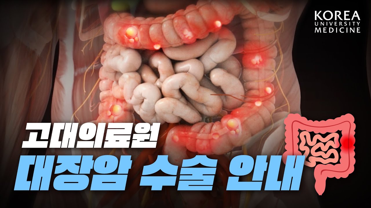 [수술 전 꼭! 확인] 대장암 수술 안내 - YouTube