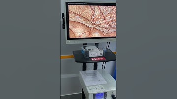 Stryker 1288 with Stryker L9000 Led Light Source | Vision Clarity