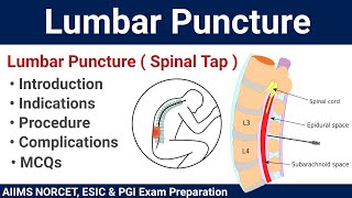 Lumbar Puncture (Spinal Tap) Procedure and MCQs