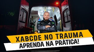 XABCDE no trauma: APRENDA NA PRÁTICA!