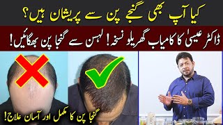 Ganjapan ka ilaj by Dr Essa | Easy treatment of hair | 92NewsHD