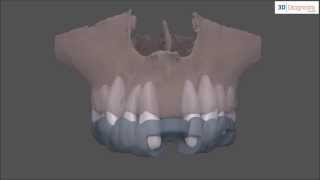 3DDX Scan Plan Guide Restoration