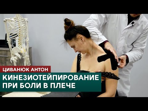 видео: Кинезиотейпирование при боли в плече. Циванюк Антон