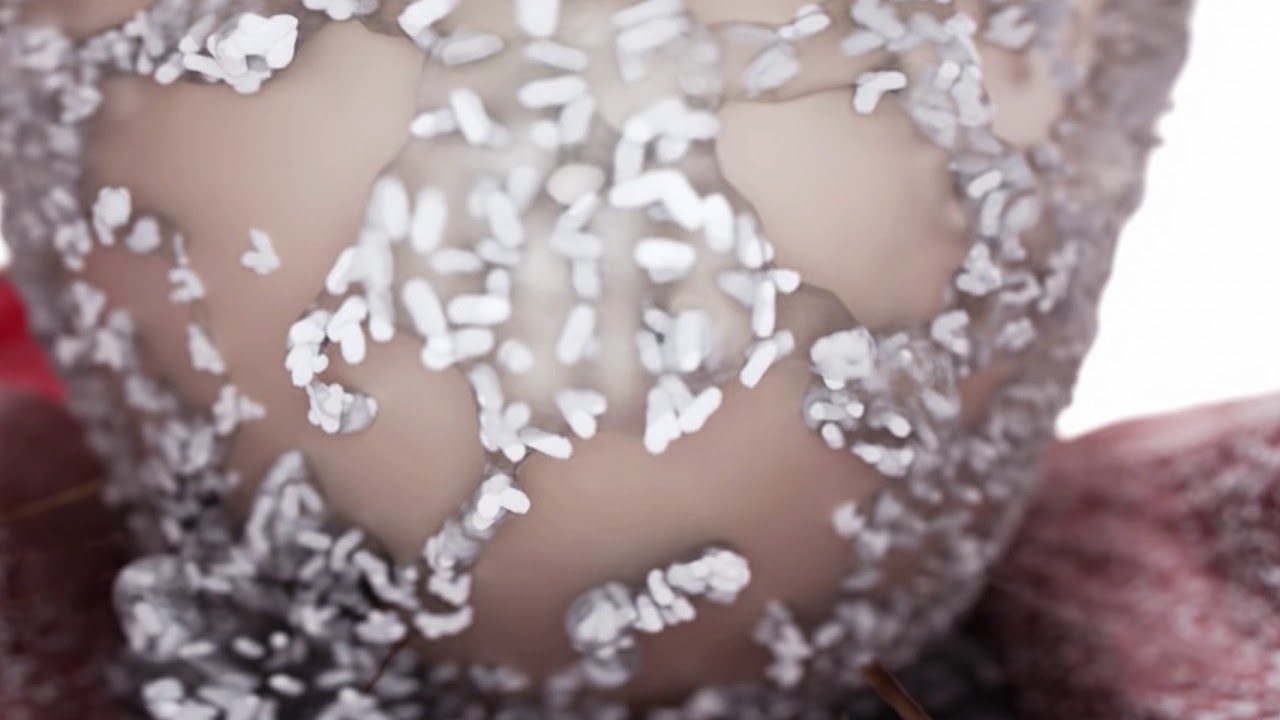 The Perio Link, liens entre maladies parodontales et diabète.