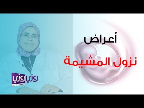 فيديو: ما هي أعراض احتباس المشيمة؟