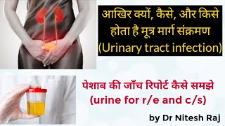 Urinary tract infections , causes, symptoms,risk factors,urine R/E test, urine C/S test
