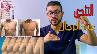 اسباب وطرق  علاج التثدى عند الرجال- gynecomastia