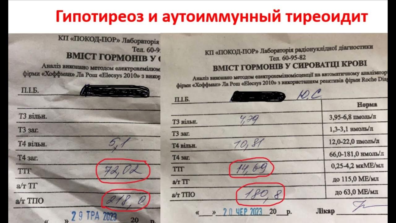 Аит код по мкб 10. Аит код по мкб 10