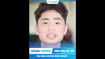 Ngô Thanh Lâm tháo niềng răng, tìm lại bản lĩnh và nụ cười tự tin tại Nha khoa Bảo Ngọc