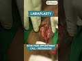 Labiaplasty Surgery, Vagina Tighten, Plastic Surgery at Elegance Clinic in Vesu, Surat