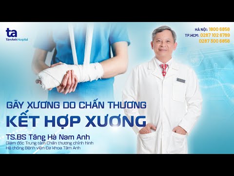 Video: 3 cách điều trị gãy xương hở khi sơ cứu