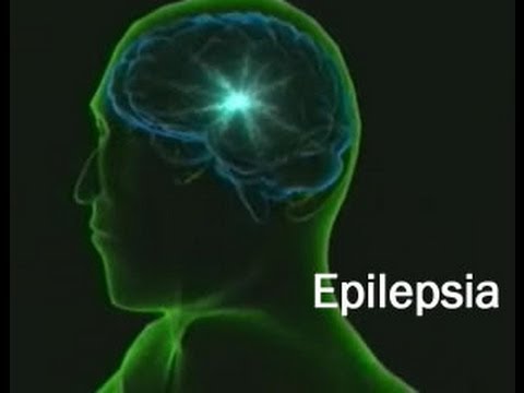Ataque epilepsia que hacer