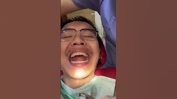 Niềng răng thôi mà tôi tưởng anh ấy thay đầu á. Siêu đẹp trai luôn #niengrang  #beauty #douyin