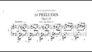 Frédéric Chopin - 24 Preludes Op.28 (Kissin)