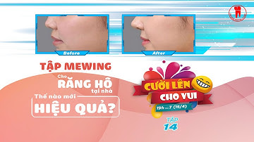 CƯỜI LÊN CHO VUI - TẬP 14: Tập Mewing có khắc phục răng hô, răng móm được không?