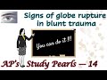 Signs of Globe Rupture In Blunt Trauma | AP&#39;s Study Pearls 14