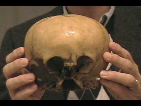 Introduction to the Starchild Skull by Lloyd Pye