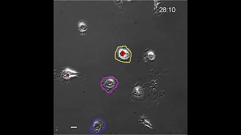 How Mycobacterium tuberculosis ‘serially kills’ macrophages