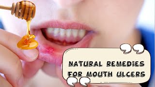 How To Relieve Mouth Ulcers Naturally And Effectively |Natural Remedies For Mouth Ulcers/Canker Sore